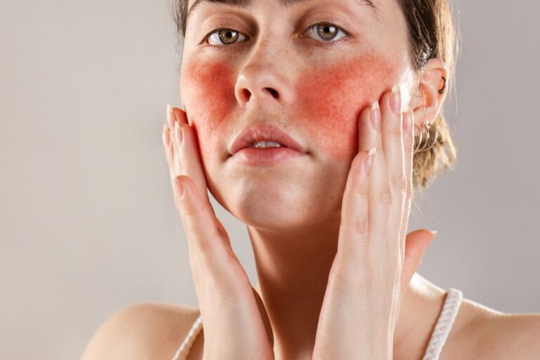 Managing Redness and Flare-ups With Expert Care
